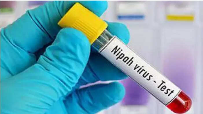 നിപ പൊസീറ്റിവ് രോഗികൾക്ക് എല്ലാ ദിവസവും ആർടിപിസിആർ ടെസ്റ്റ്